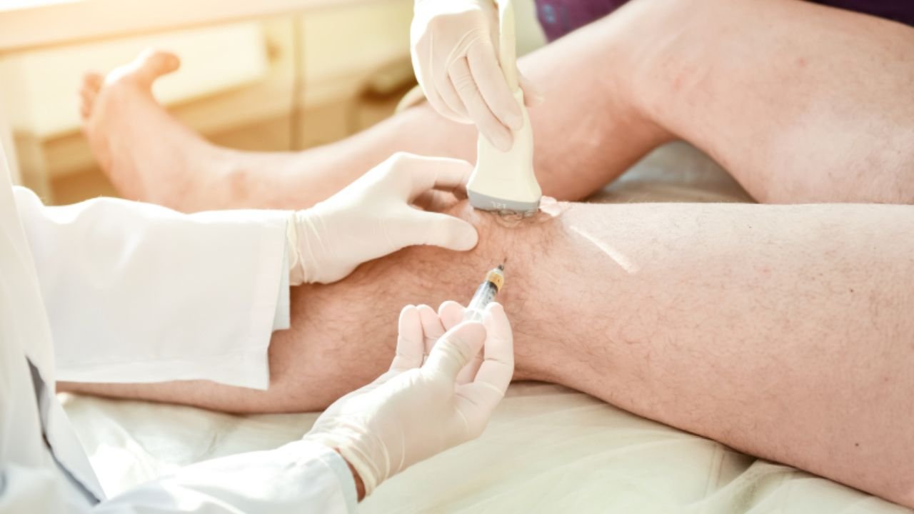 Infiltração Guiada por Ultrassom